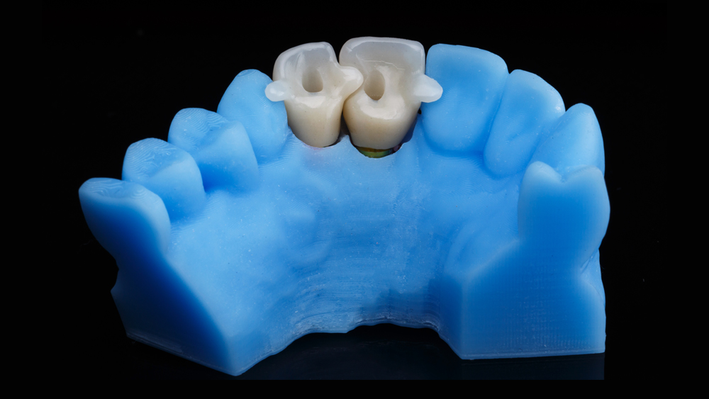 M & D Dental Arts LLC_Service_3d-dental-model