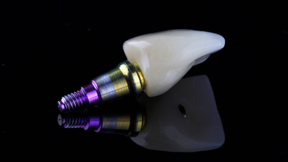 M & D Dental Arts LLC_Service_custom-abutments